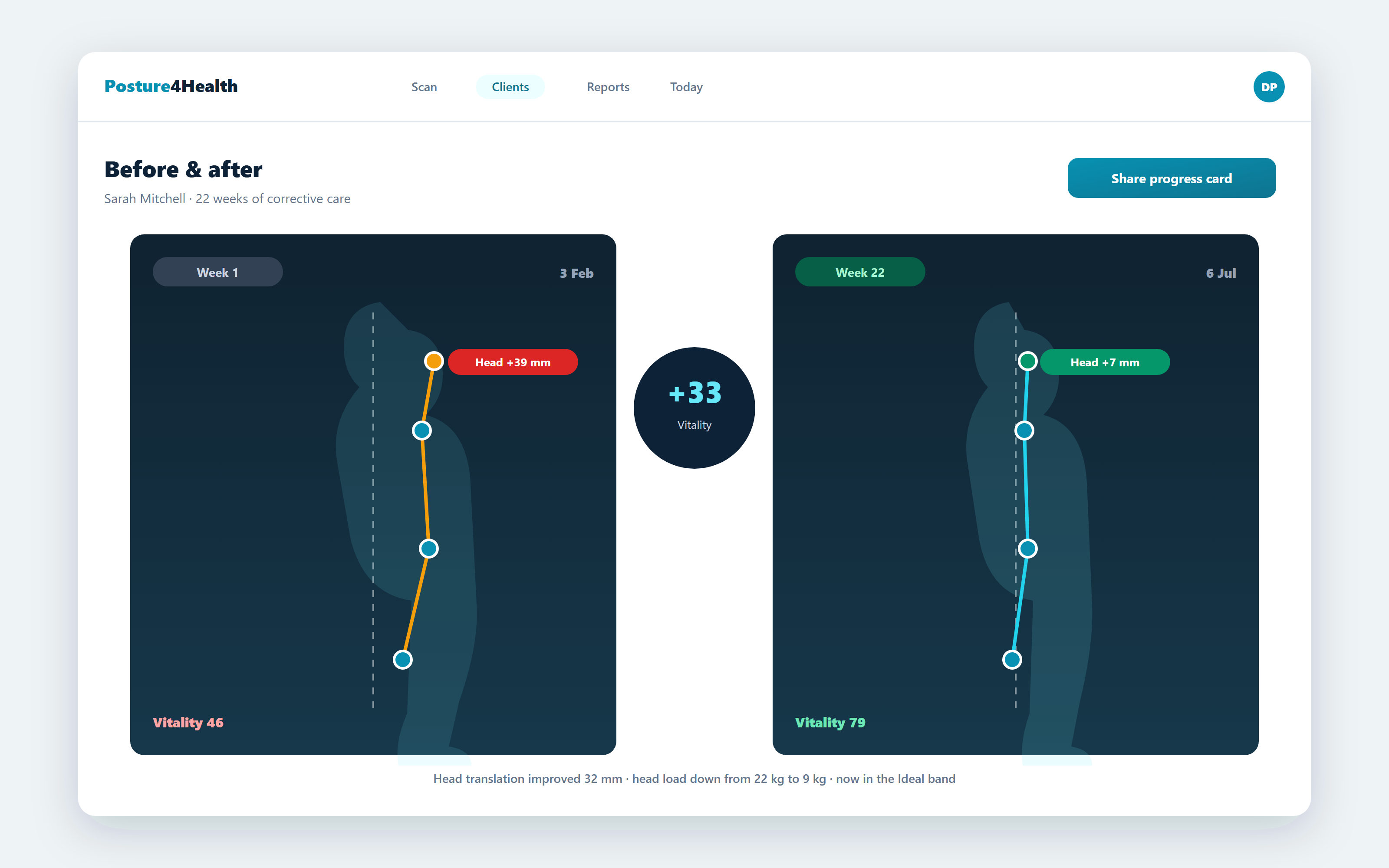 Before and after posture comparison showing a 33-point Vitality Score improvement with a share progress card button