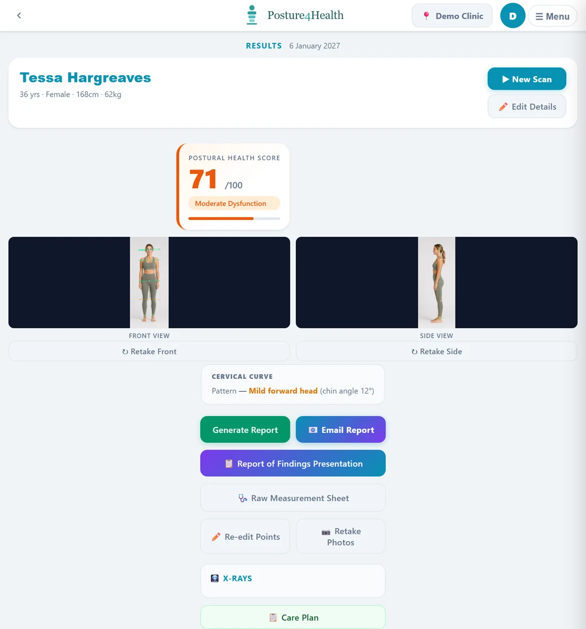 The practitioner results screen with the score, photographs and report buttons