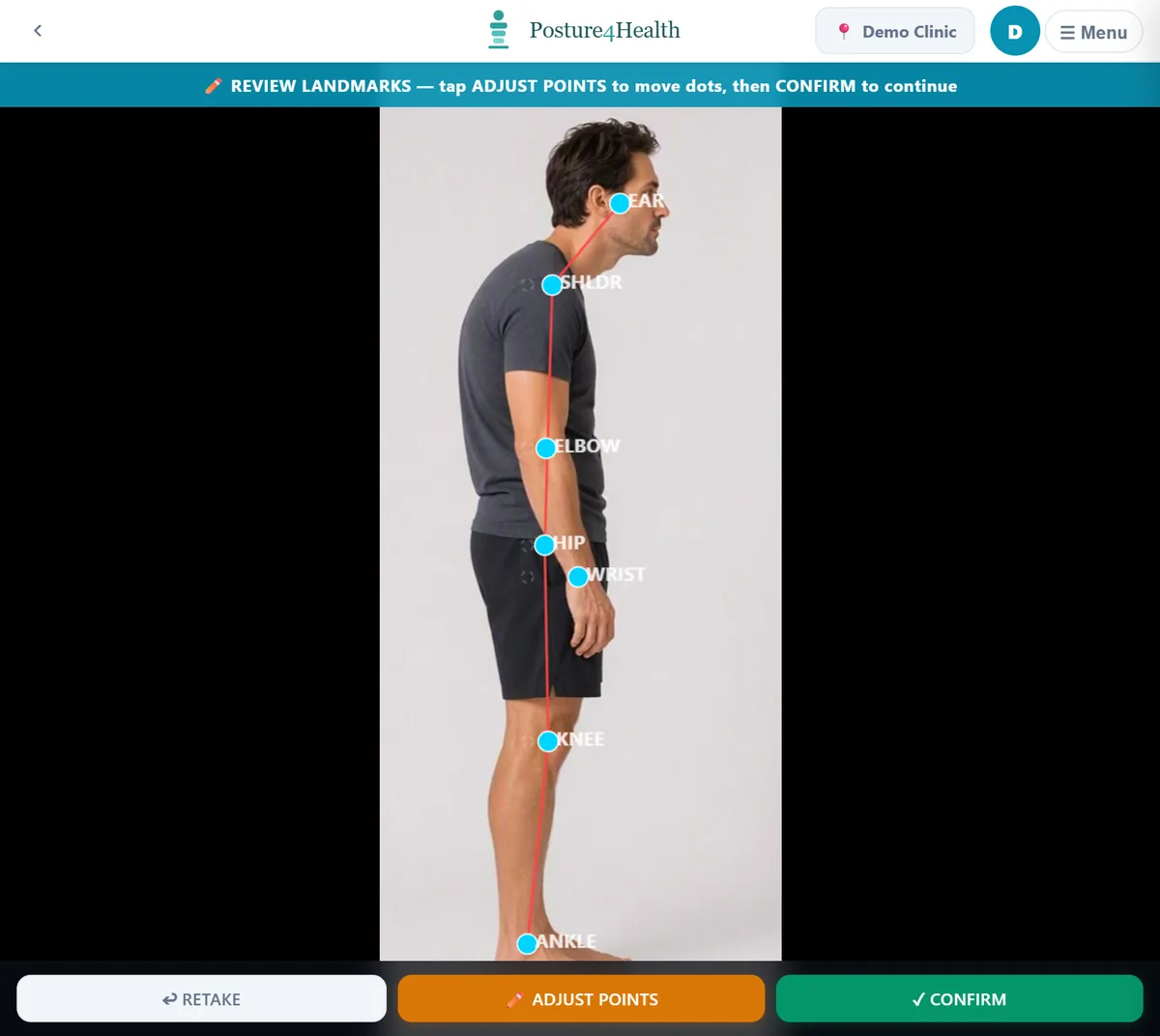 The landmark review screen with labelled points and Retake, Adjust Points and Confirm buttons